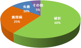 歯ブラシをしっかりやり、メインテナンスを定期的に受けている人の抜歯の原因 歯ブラシをしっかりやり、メインテナンスを定期的に受けている人の抜歯の原因