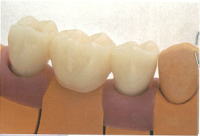 歯のイメージ 歯のイメージ