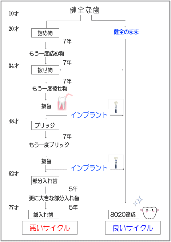 歯が失われるサイクル