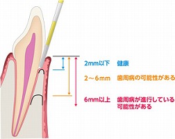歯の構造図 歯の構造図