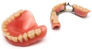 総入れ歯でもインプラントはできますか？