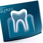 歯科治療での麻酔その１～麻酔の痛みは昔より軽減？～