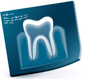 歯科治療での麻酔その１～麻酔の痛みは昔より軽減？～