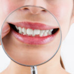 お口周りの癖はありませんか?~口腔習癖がもたらすトラブル~