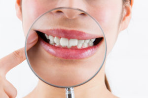 お口周りの癖はありませんか？～口腔習癖がもたらすトラブル～