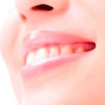 セルフホワイトニングは要注意？！～歯科医院で行うホワイトニングとの違い～