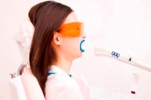 ホワイトニング後の注意～後戻りってするの？～