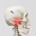 口が開かない?~顎関節症の原因って何~