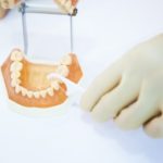 インプラント周囲炎と歯周病の違いを教えて下さい