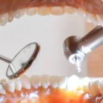 全身疾患と口腔内の状態は関係あるって知っている?(1)